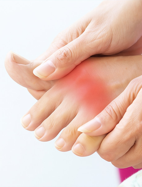 Gout Treatment